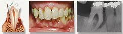 Westwood Dentist, Dentist Westwood, Dr. Philip Aurbach, Old hook Dental