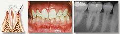 Westwood Dentist, Dentist Westwood, Dr. Philip Aurbach, Old hook Dental