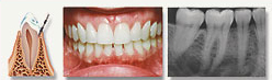 Westwood Dentist, Dentist Westwood, Dr. Philip Aurbach, Old hook Dental