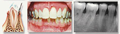 Westwood Dentist, Dentist Westwood, Dr. Philip Aurbach, Old hook Dental