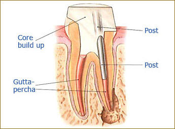 Westwood Dentist, Dentist Westwood, Dr. Philip Aurbach, Old hook Dental