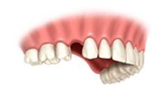 Westwood Dentist, Dentist Westwood, Dr. Philip Aurbach, Old hook Dental