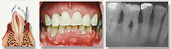 Westwood Dentist, Dentist Westwood, Dr. Philip Aurbach, Old hook Dental