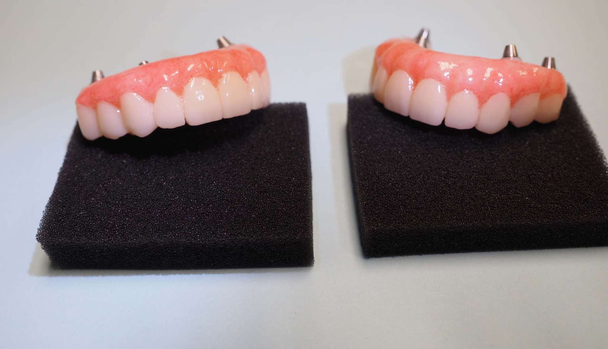 Dental Implant tooth Restoration